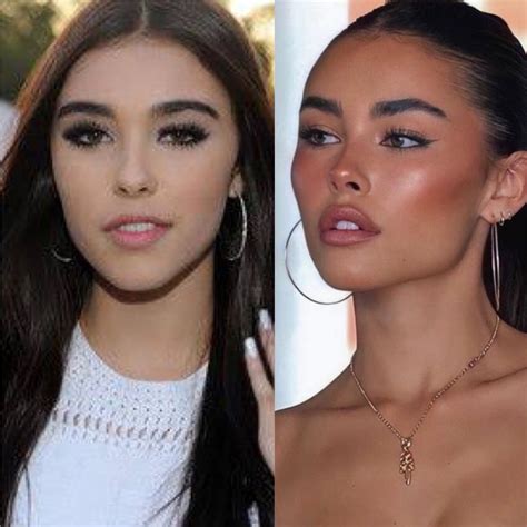 madison beer plastic sugery|Madison Beer Responds To Cosmetic Surgery Allegations